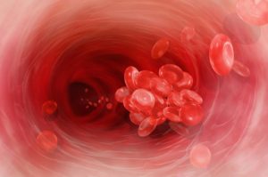 żylna choroba zakrzepowo-zatorowa